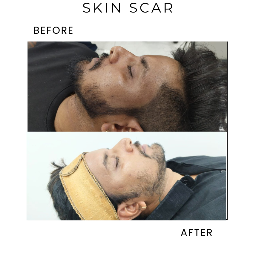 Skin Scare