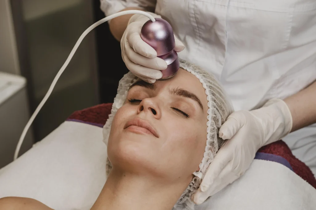 MNRF (Microneedling Radiofrequency)